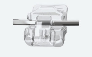 New Technology Dental Tool 1